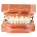 Aparat ortodontyczny - higiena