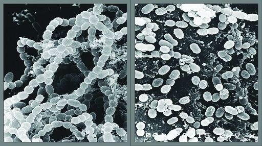 Bakterie przed i po dzialaniu Ultradzwiekow.