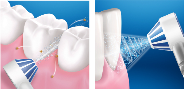 jak używać iryagtor Oral-B AQUACARE 6 