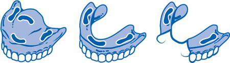 Jak nakładać klej do protez FittyDent Denture Jak nakładać klej do protez FittyDent Denture