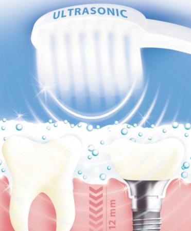 technologia ultradźwiękowa w szczoteczkach elektrycznych