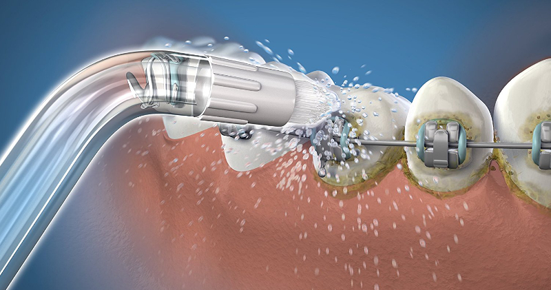 WATERPIK WOD-2E ortodontyczne końcówki do irygatora