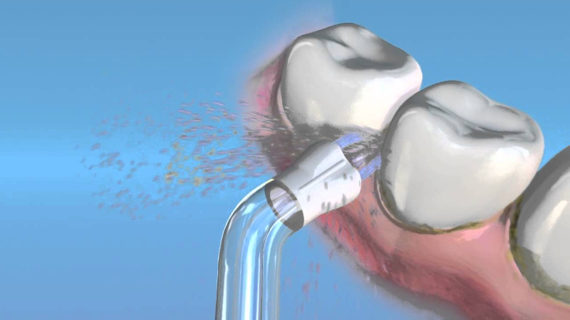 WATERPIK WPS-2E końcówki do pielęgnacji implantów, mostów