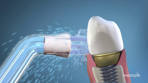 Waterpik PS-100 końcówka do implantów Waterpik PS-100 końcówka do implantów