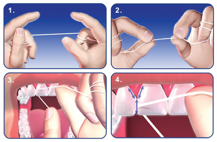 technika użycia nici dentystycznych