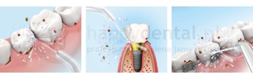waterpik WP-861E2 waterpik WP-861E2