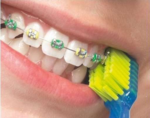 Curaprox CS 5460 Ortho Curaprox CS 5460 Ortho