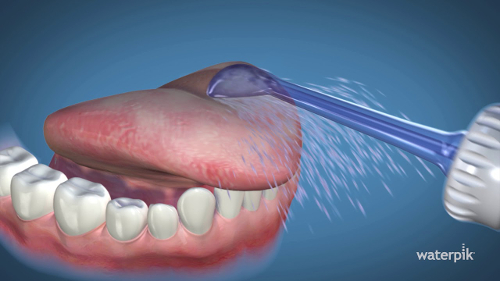 końcówka do czyszczenia języka Waterpik TC-100