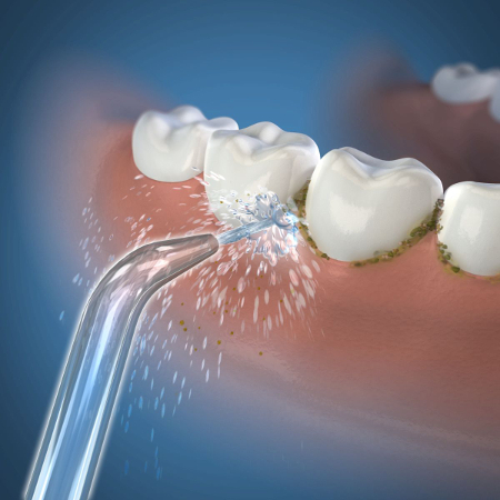 końcówki do irygatora Waterpik JT-100