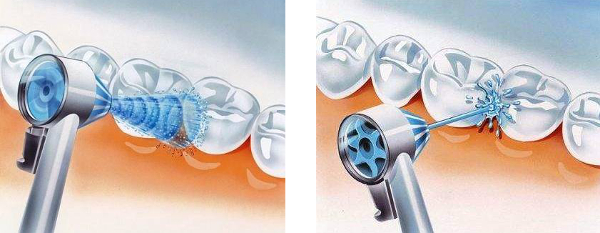 rodzaje strumienia wody w irygatorze do zębów Oral-B MD20