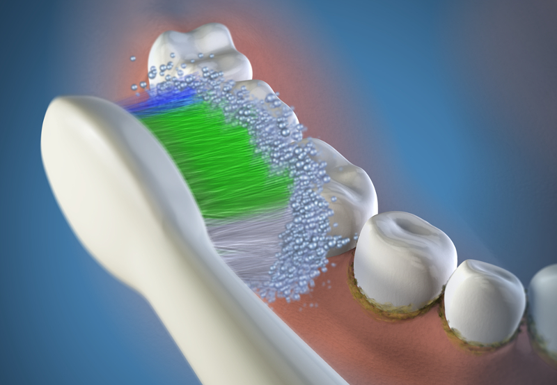 szczoteczka soniczna sonicare