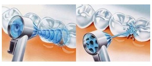 zasada działania irygatorów do zębów ORAL-B Braun zasada działania irygatorów do zębów ORAL-B Braun